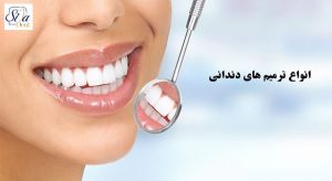 آمالگام