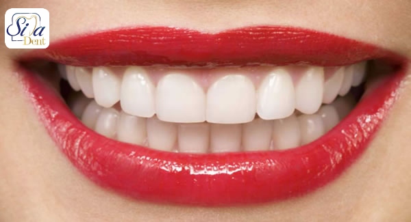 دندانپزشکی زیبایی