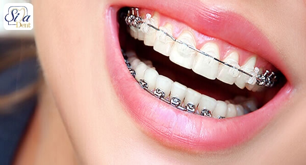 ارتودنسی دندان چیست