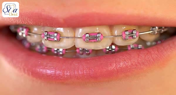 Orthodontics