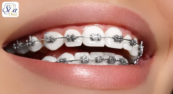 Orthodontics