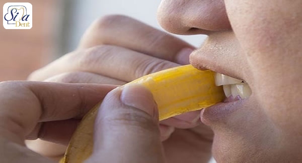 راه های سفیدی دندان در خانه به کمک روش های طبیعی