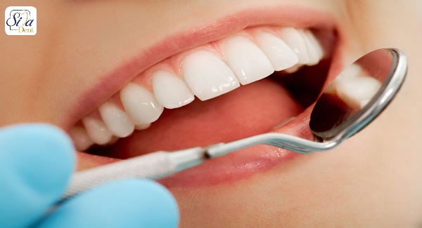 چکاپ دندان  تشخیص به موقع سرطان دهان