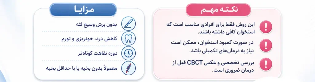 ایمپلنت بدون جراحی