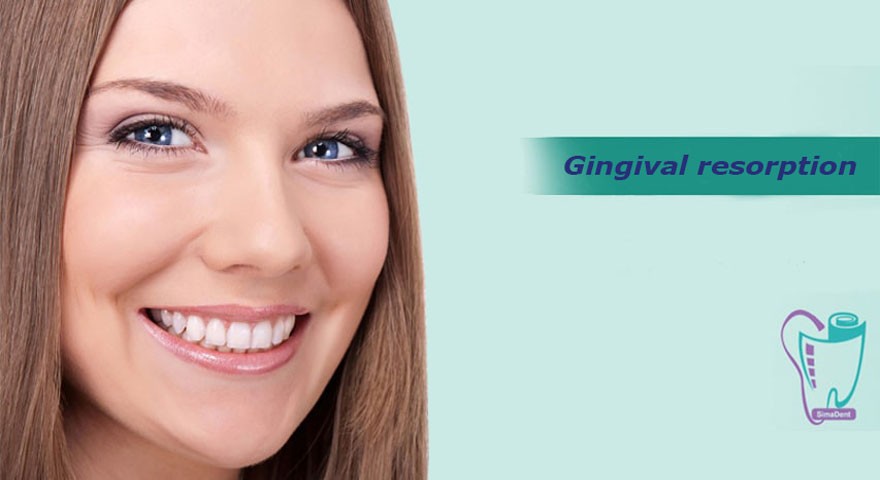 Gingival resorption