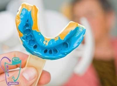 Invisalign