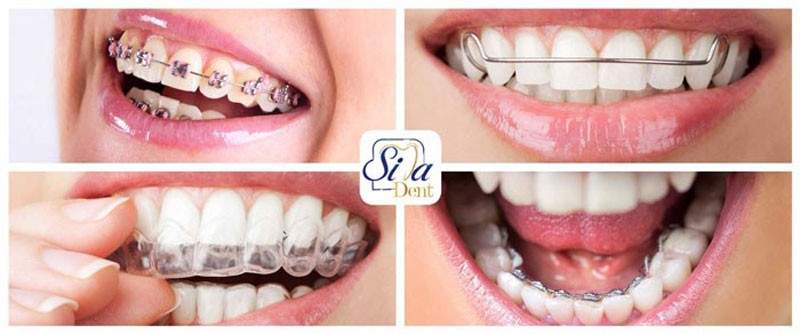 Orthodontics