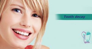 Tooth decay