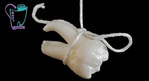 Dental extraction