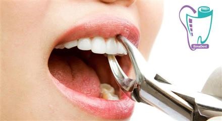 Dental extraction
