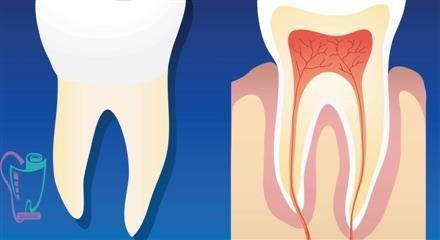 Dental sensitivity