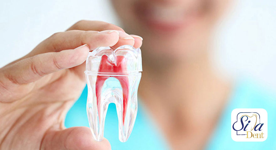 درمان ریشه دندان عقب