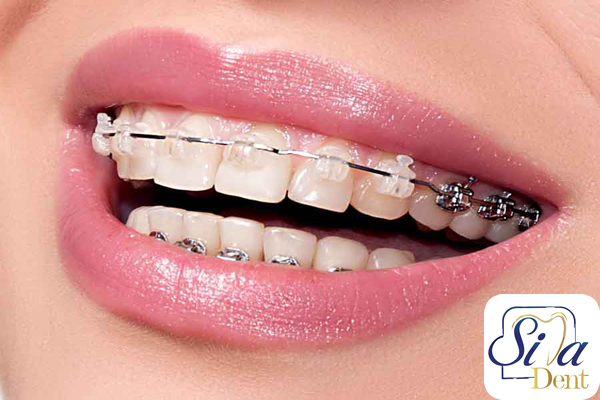 دیگر موارد اورژانس ارتودنسی
