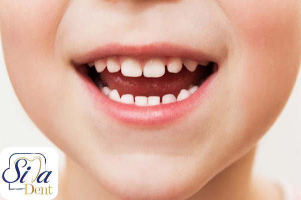 تعداد دندانهای شیری