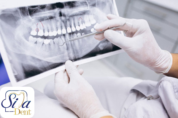 رادیولوژی و رادیوگرافی دیجیتال دندان