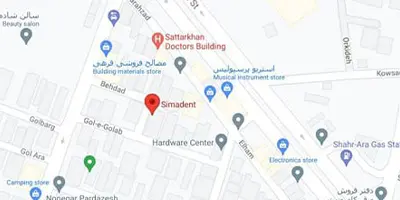 ارتودنسی نامرئی چیست؟ | راهنمای صفر تا صد ارتودنسی شفاف