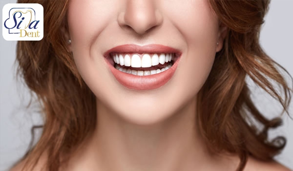 درمان نامرتبی دندان ها