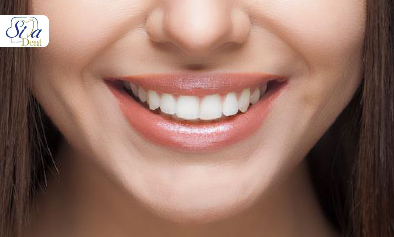 راهکار افزایش ماندگاری ایمپلنت دندان