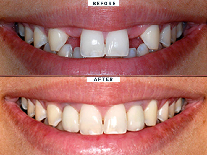 simadentclinic dental implant portfolio 5