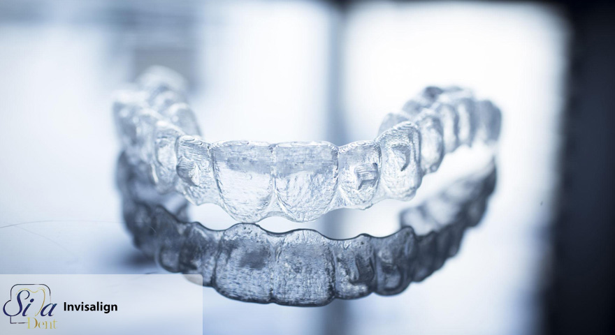 How Does Invisible Orthodontics Work