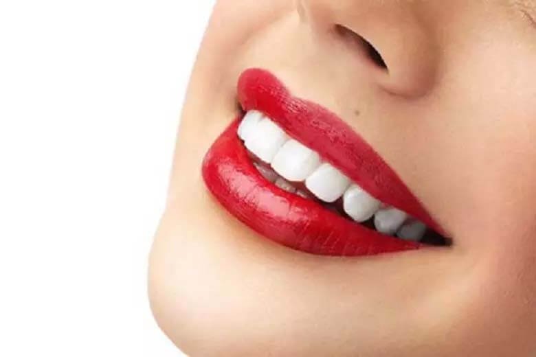 فواید کامپوزیت دندان