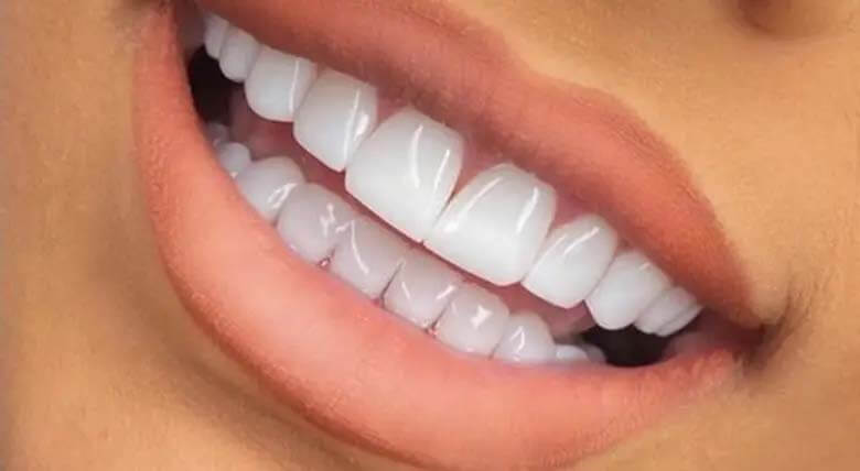 چه کسانی نباید کامپوزیت دندان کنند؟