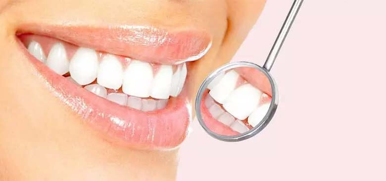 بررسی کامل تفاوت لمینت و کامپوزیت