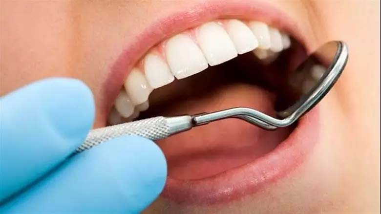 بررسی کامل تفاوت لمینت و کامپوزیت