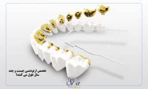 تخصص ارتودنسی چیست و چند سال طول می کشد؟