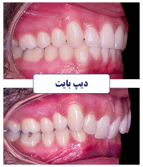 متخصص ارتودنسی