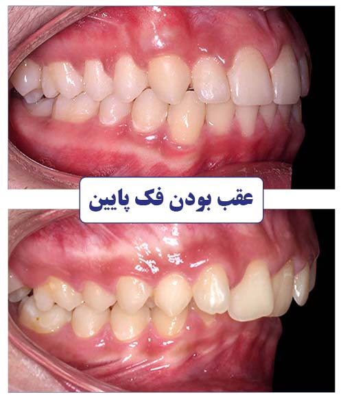 متخصص ارتودنسی