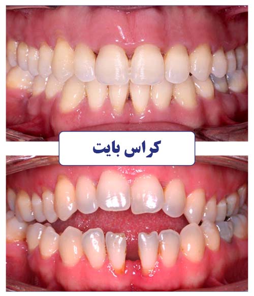 کراس بایت