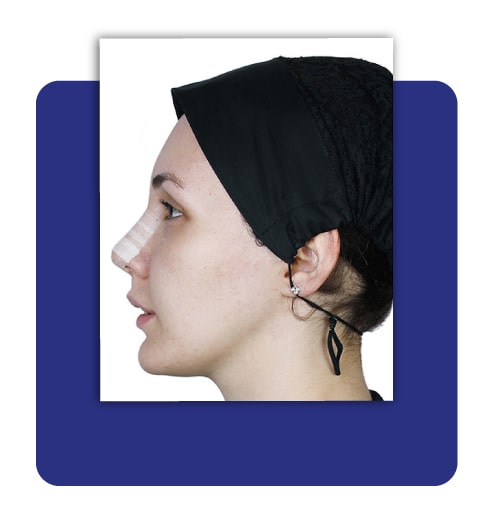 بعد از ارتوسرجری