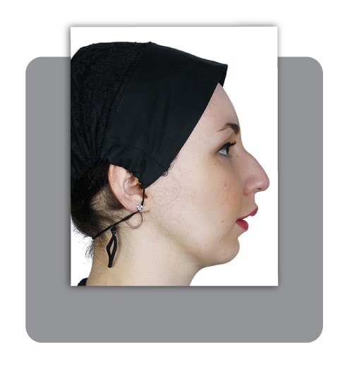 قبل از ارتوسرجری