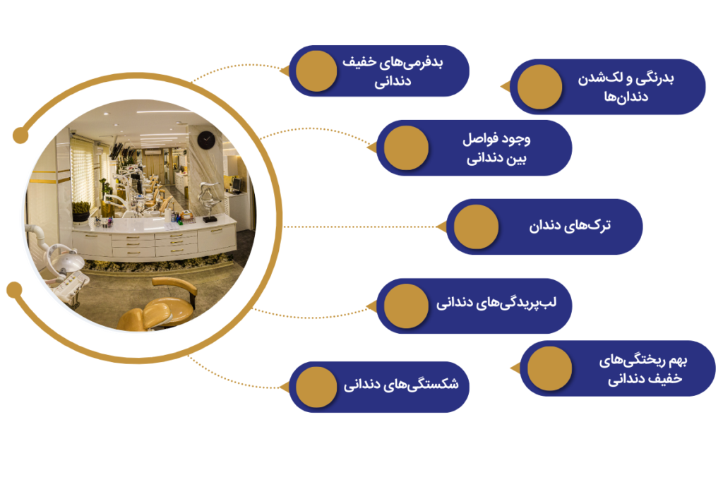کامپوزیت دندان : عوارض کامپوزیت، عکس قبل و بعد + هزینه