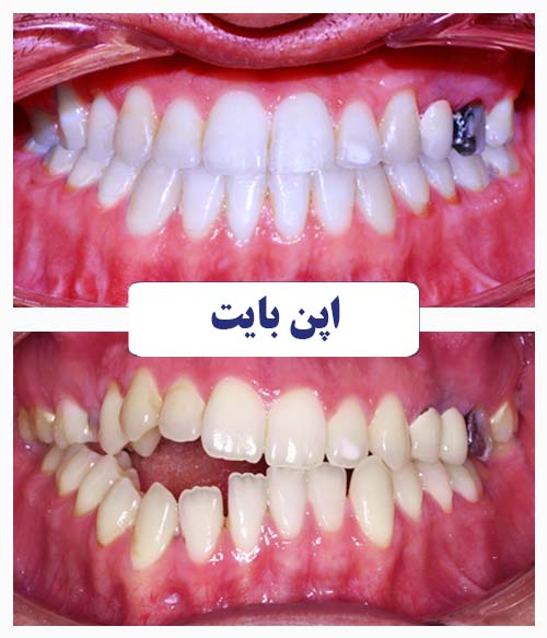 اپن بایت ناقرینه