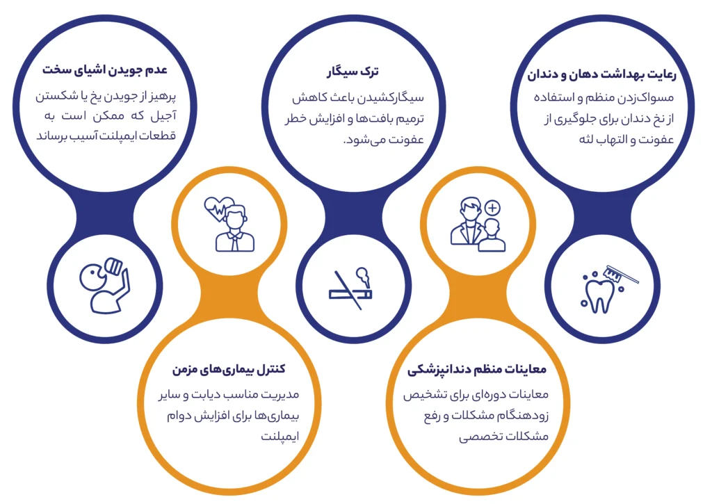 ایمپلنت دندان