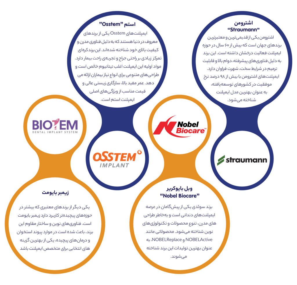 ایمپلنت دندان
