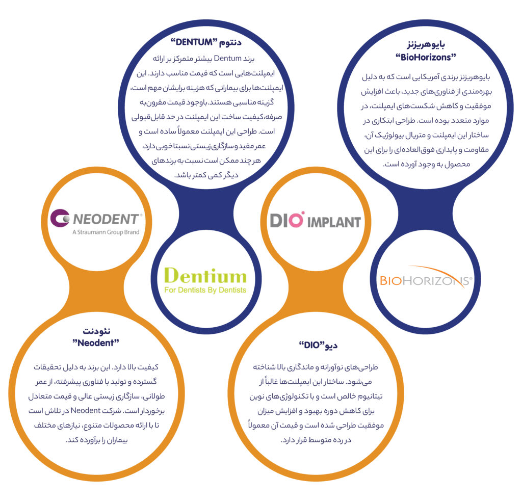 ایمپلنت دندان
