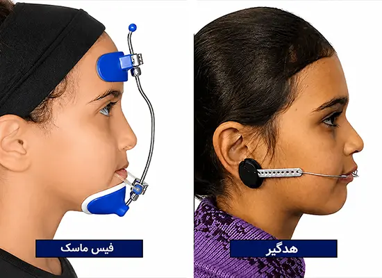 هزینه ارتودنسی دندان 1405 | جدول قیمت ارتودنسی (قسطی و بیمه)