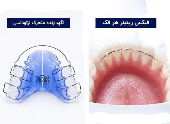 هزینه ارتودنسی دندان 1405 | جدول قیمت ارتودنسی (قسطی و بیمه)