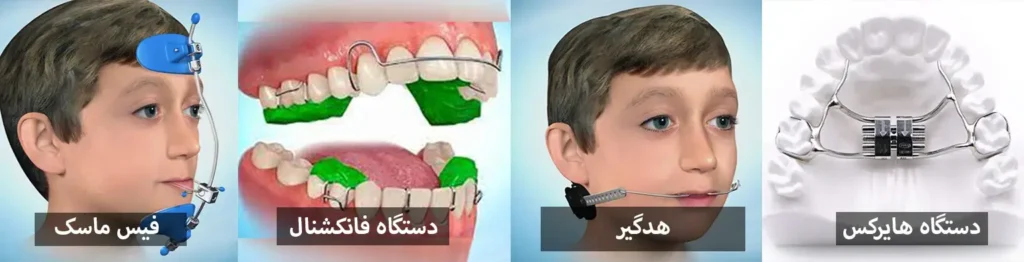 هزینه ارتودنسی دندان 1405 | جدول قیمت ارتودنسی (قسطی و بیمه)
