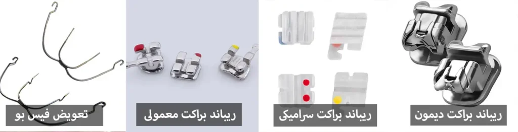هزینه ارتودنسی دندان 1405 | جدول قیمت ارتودنسی (قسطی و بیمه)