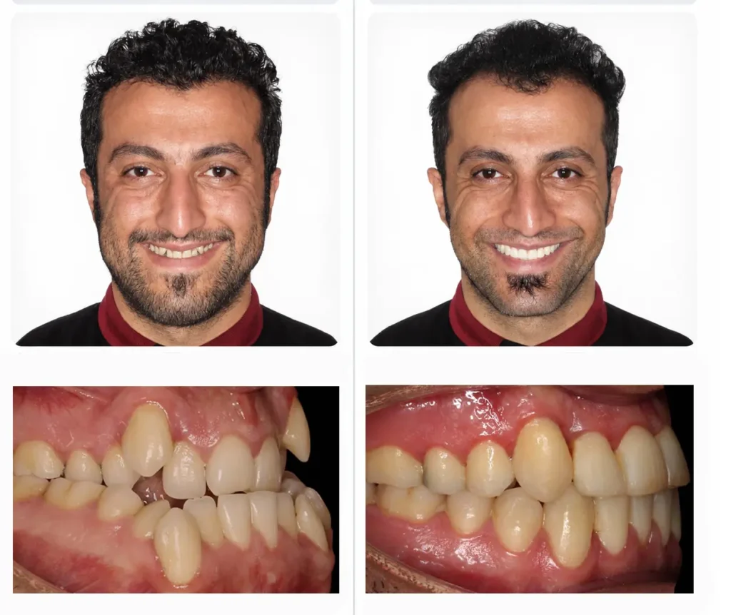 هزینه جراحی فک در سال ۱۴۰۵ چقدر است؟ بررسی قیمت یک فک، دو فک و ارتودنسی
