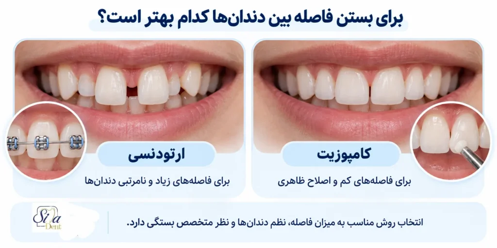 ارتودنسی بهتر است یا کامپوزیت؟